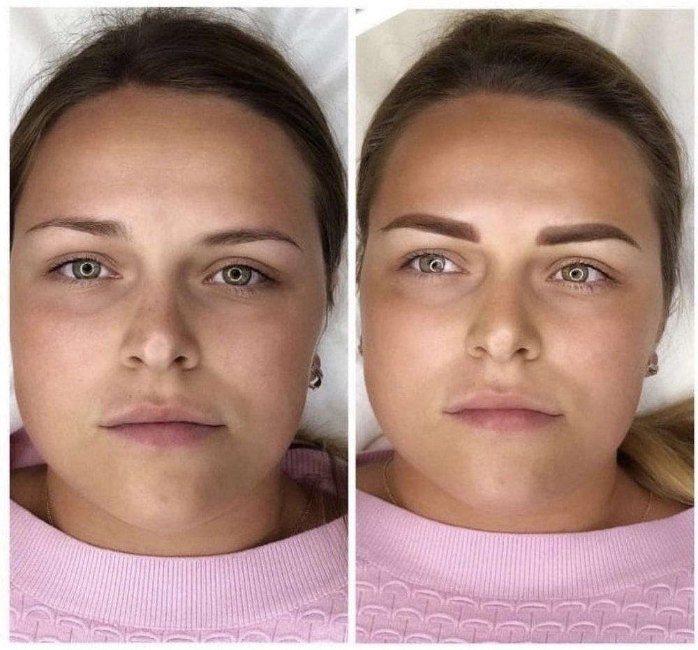 Исправление асимметрии бровей