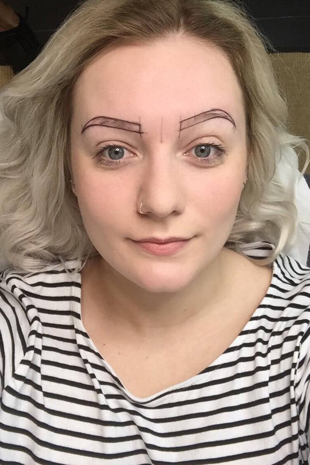 Асимметрия бровей