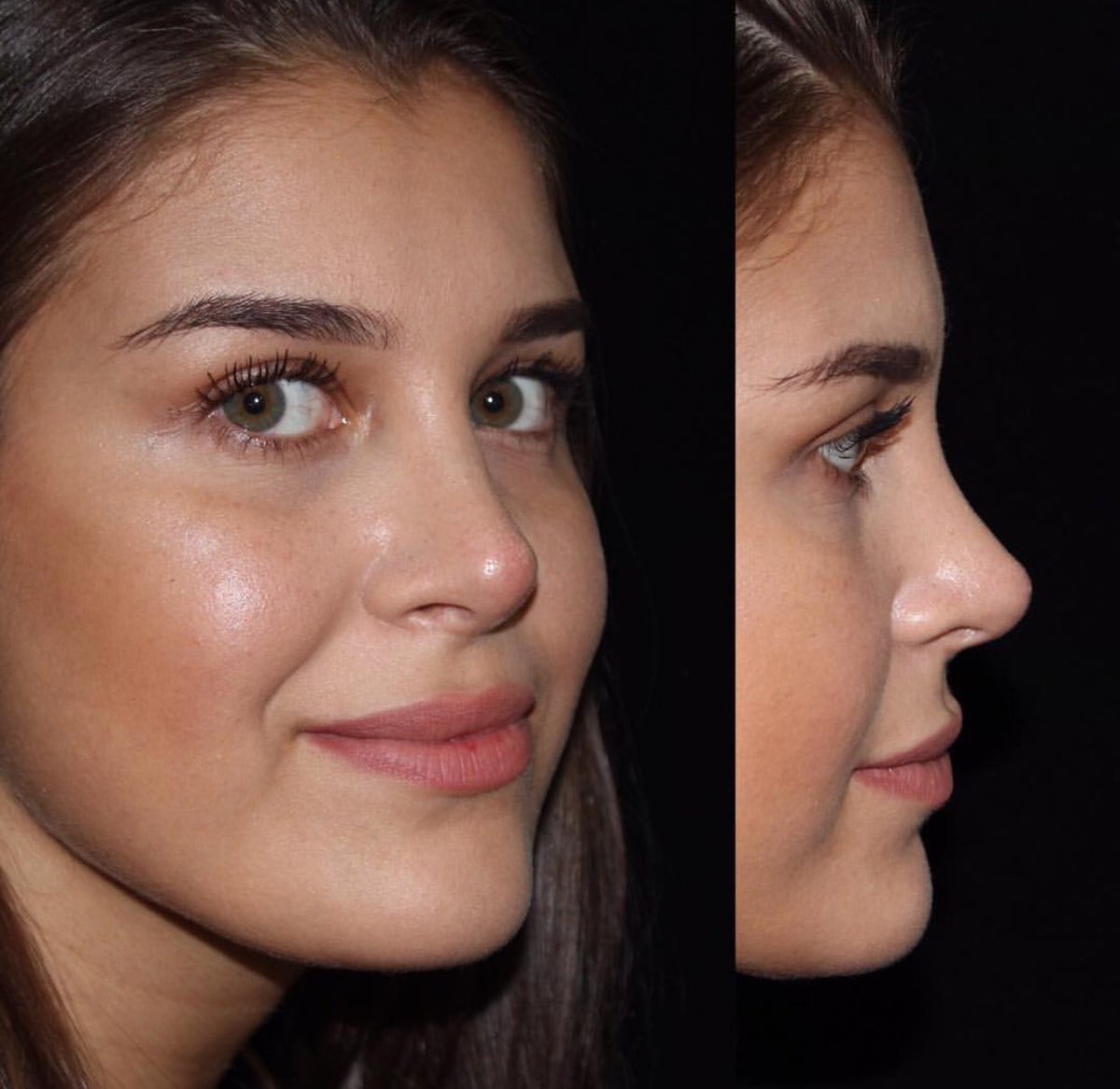 Контуринг лица