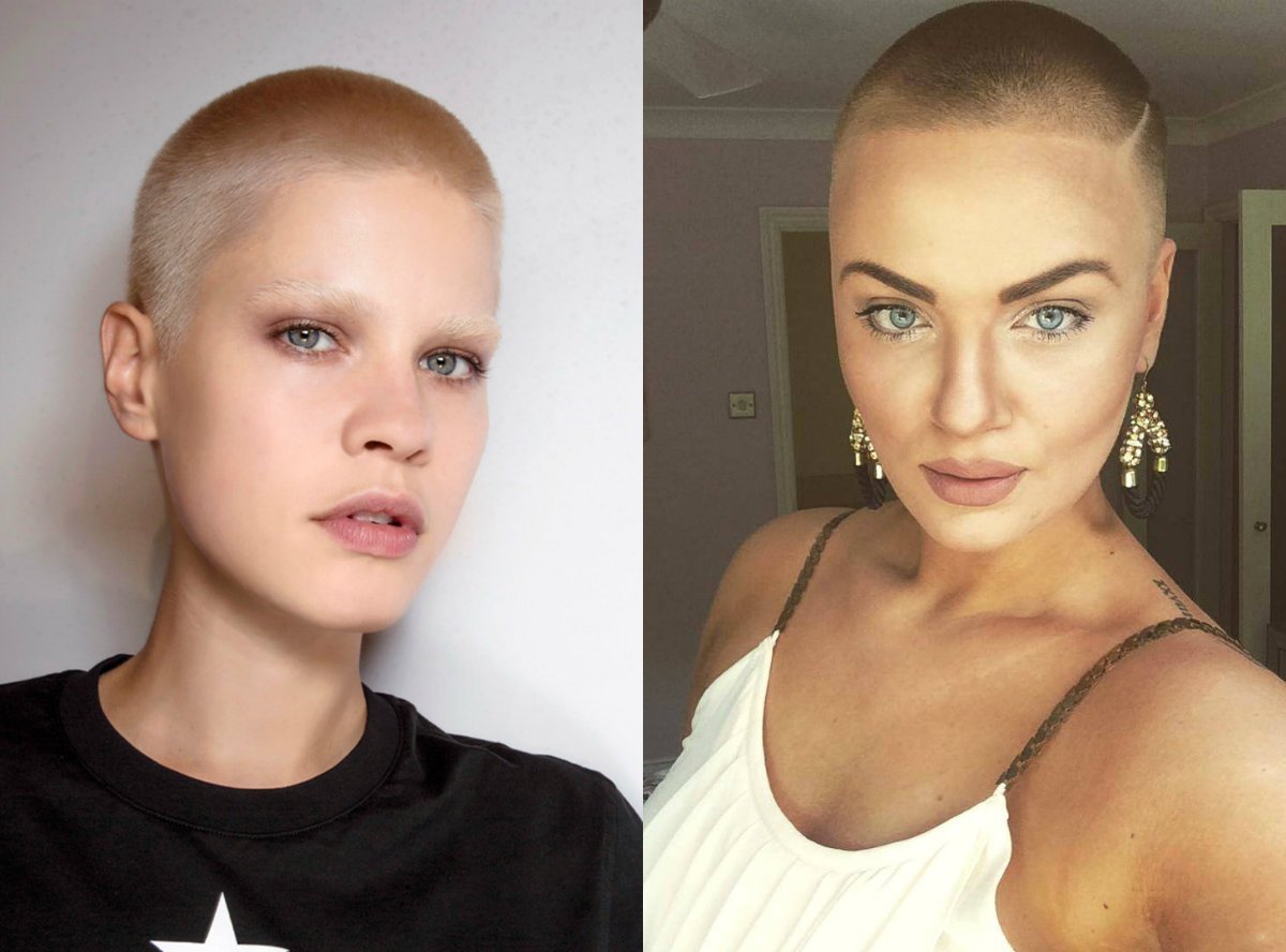 Длинные волосы с лысиной