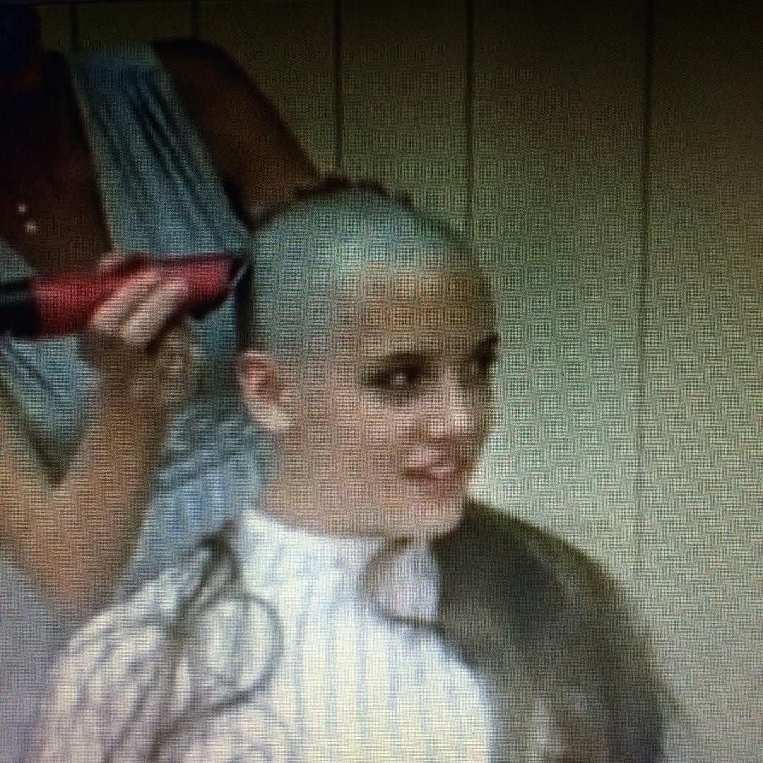 Диана чарогян лысая