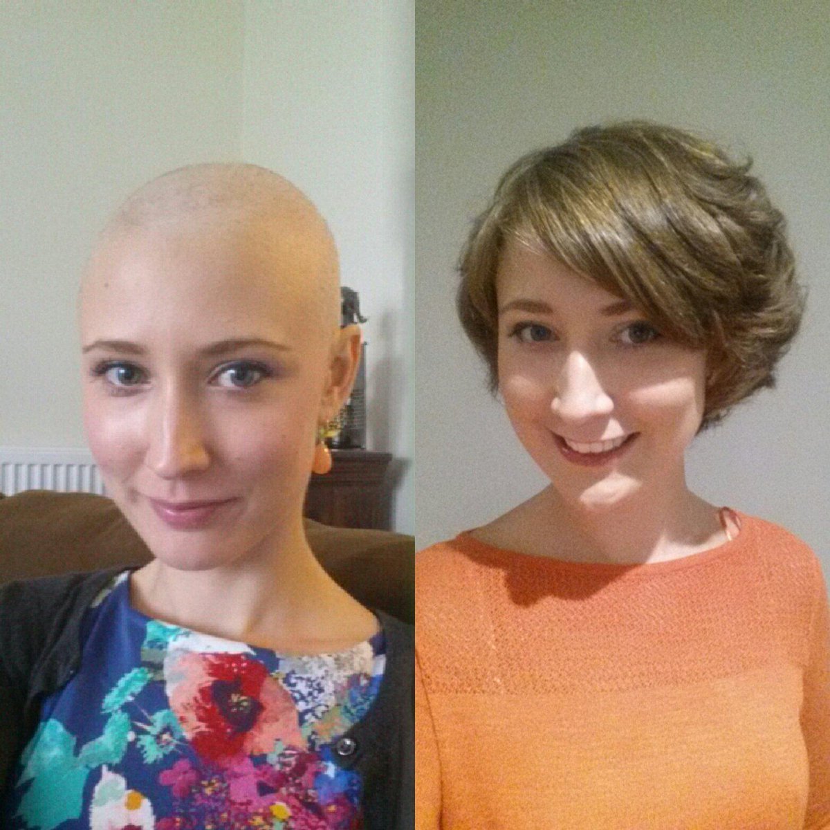 Юля гаврилина подстриглась налысо