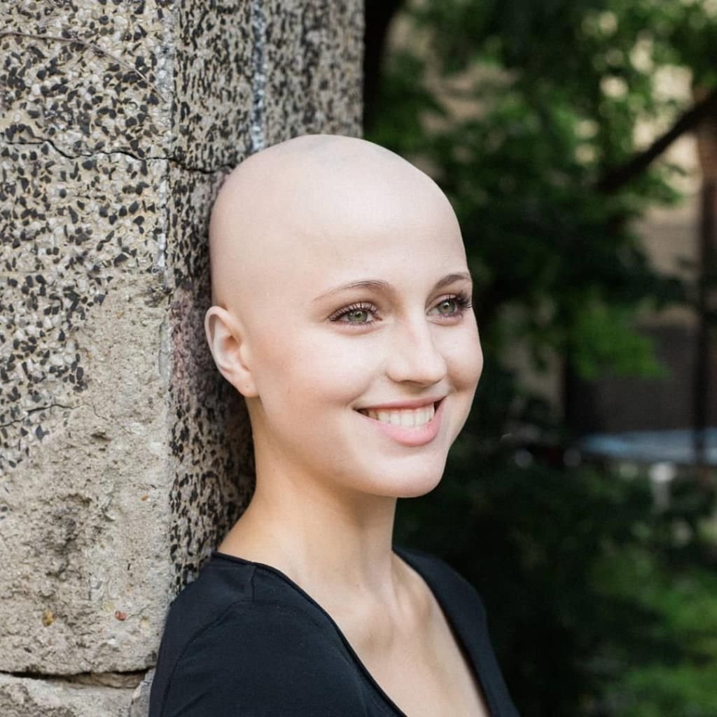 Наташа Уайтман лысая