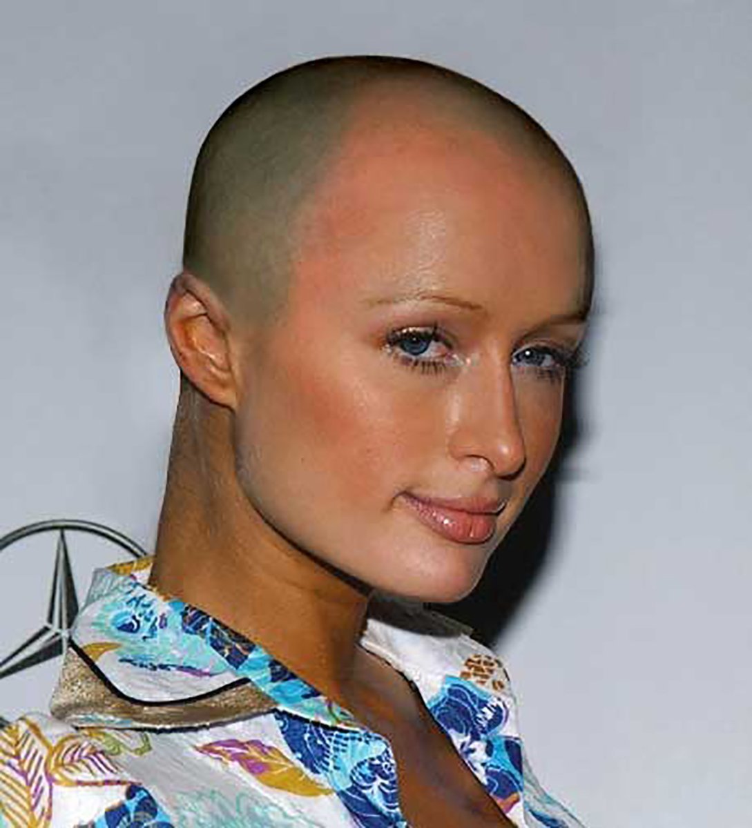 Волосы после химиотерапии