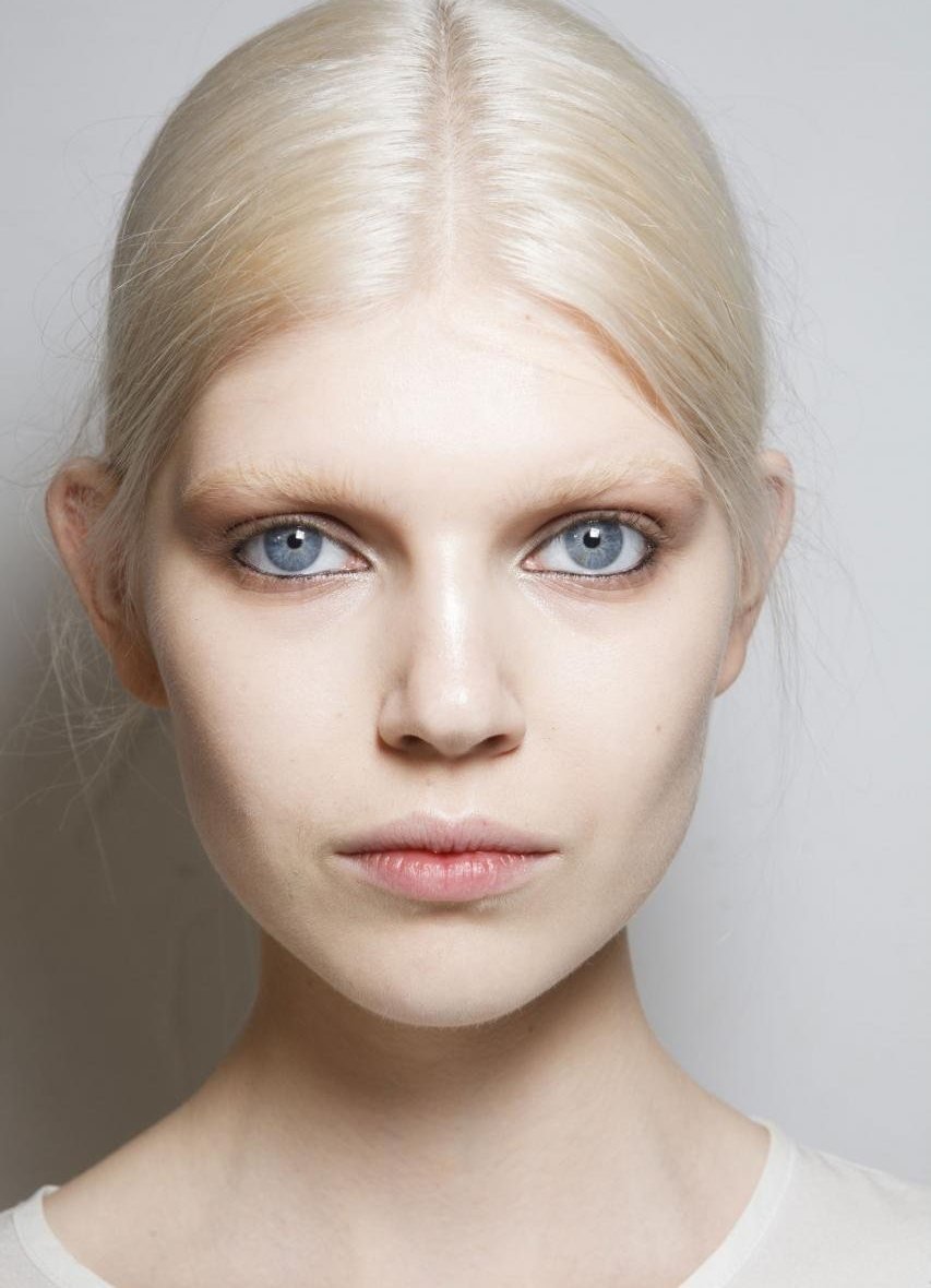 Белесые брови