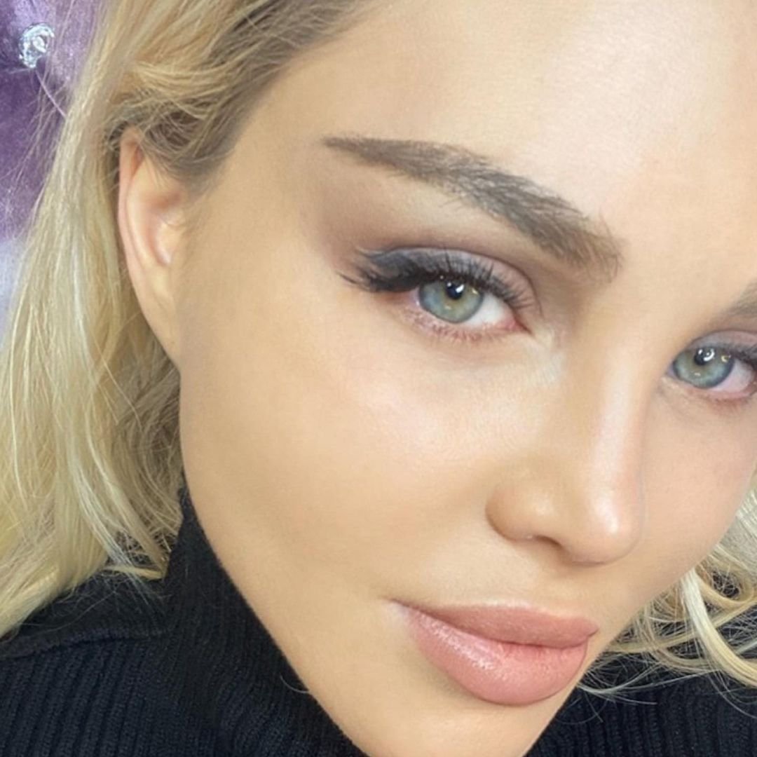 Пересаживание бровей до и после