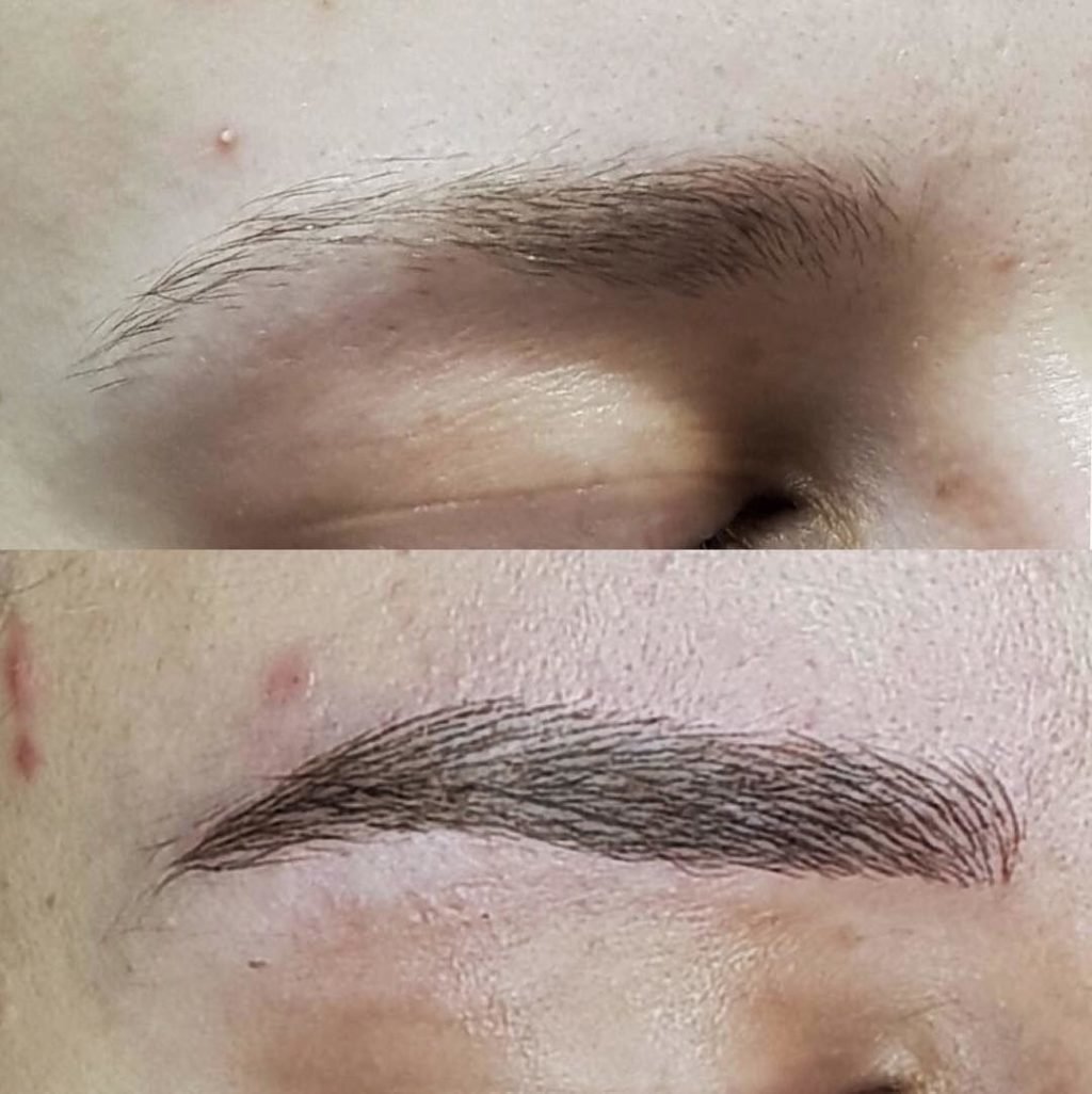 Клиника по пересадке волос