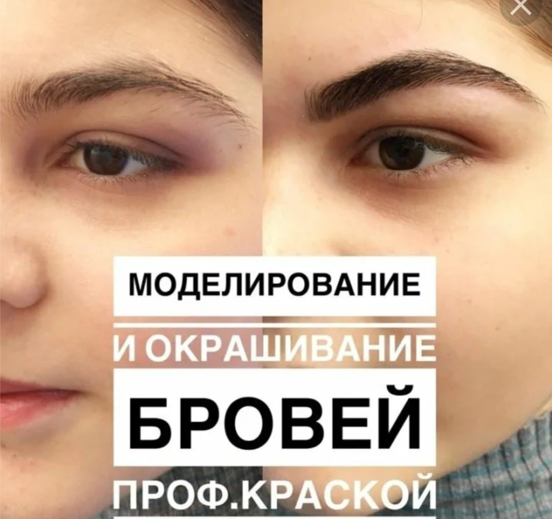 Пересаживание бровей