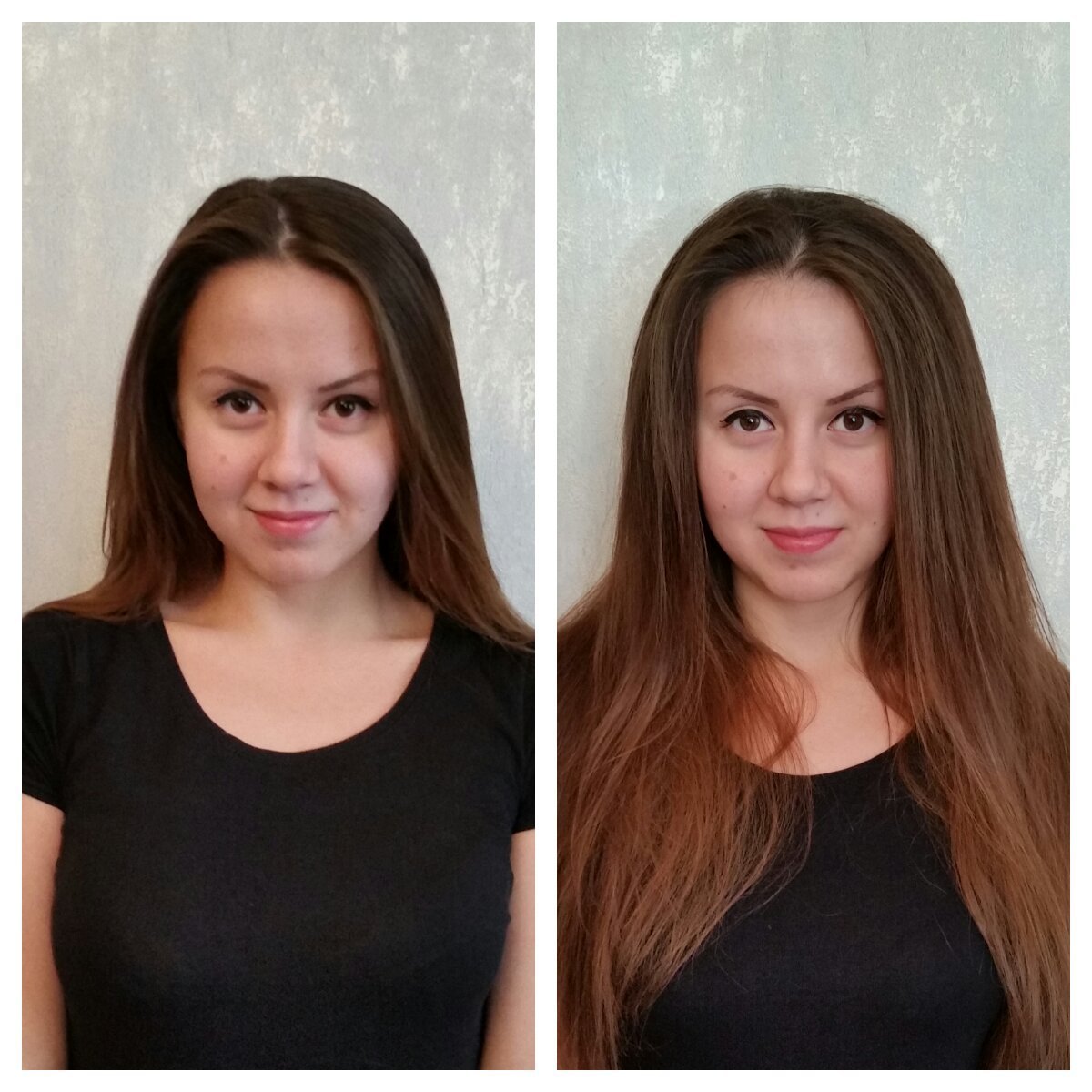 Гофре у корней