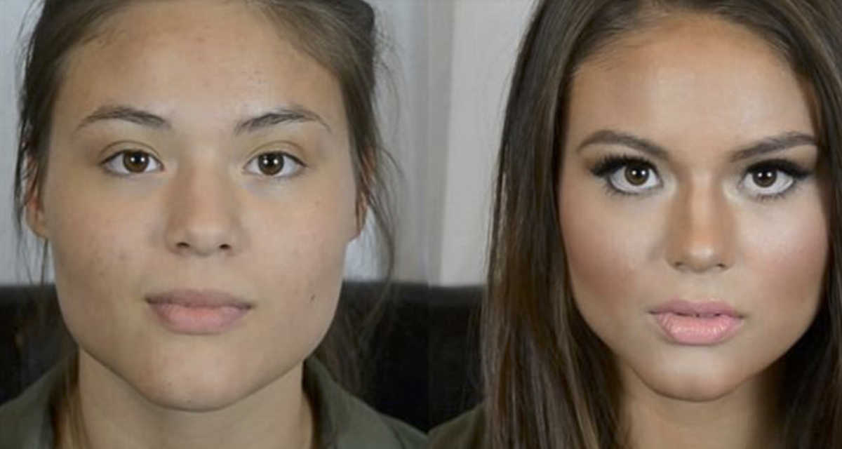 Асимметрия бровей