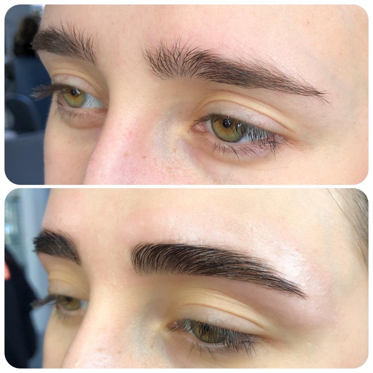 Горизонтальная асимметрия бровей