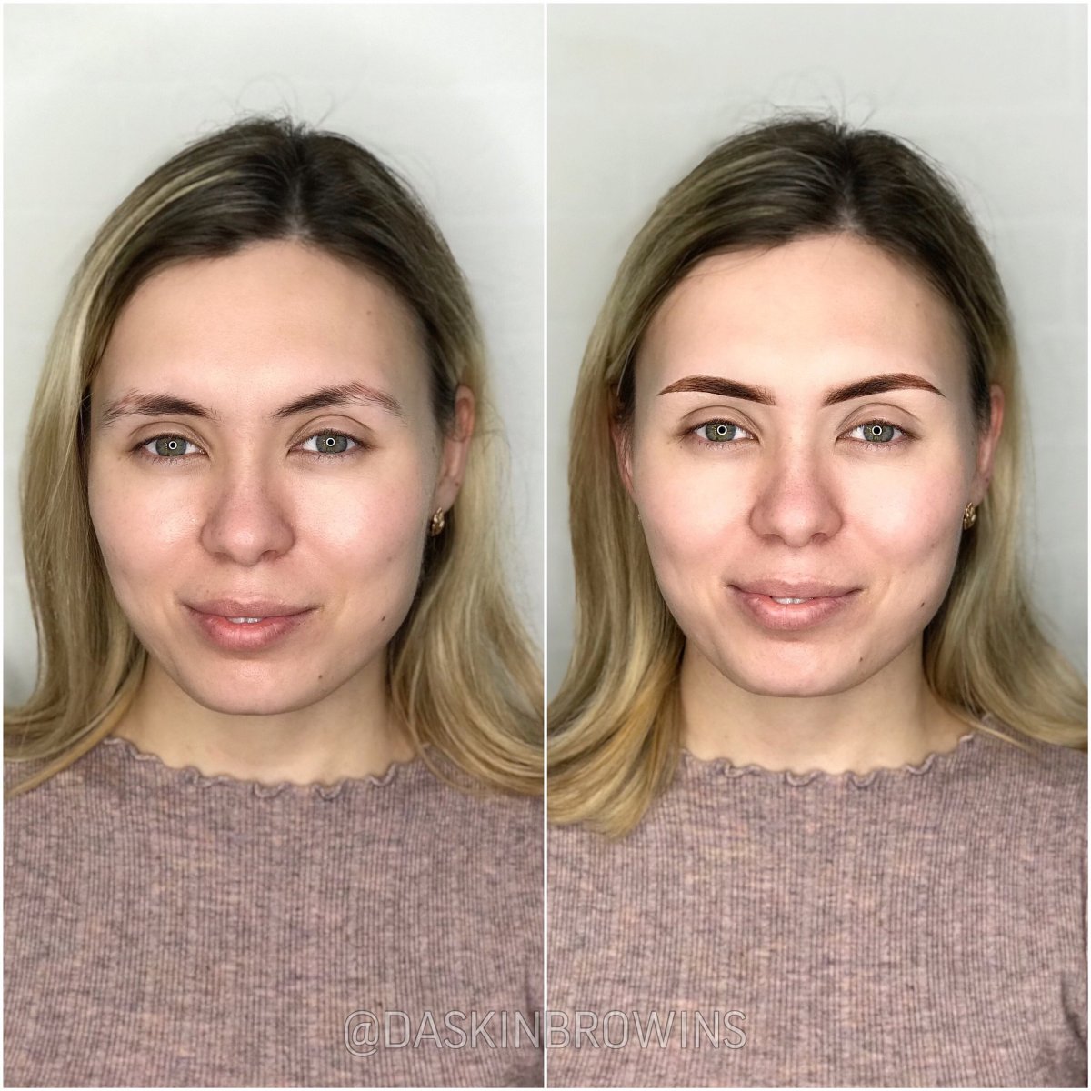 Асимметрия бровей