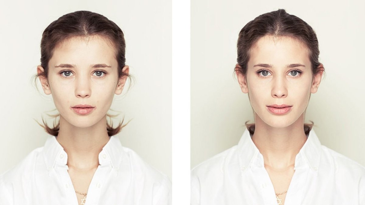 Мимическая асимметрия бровей