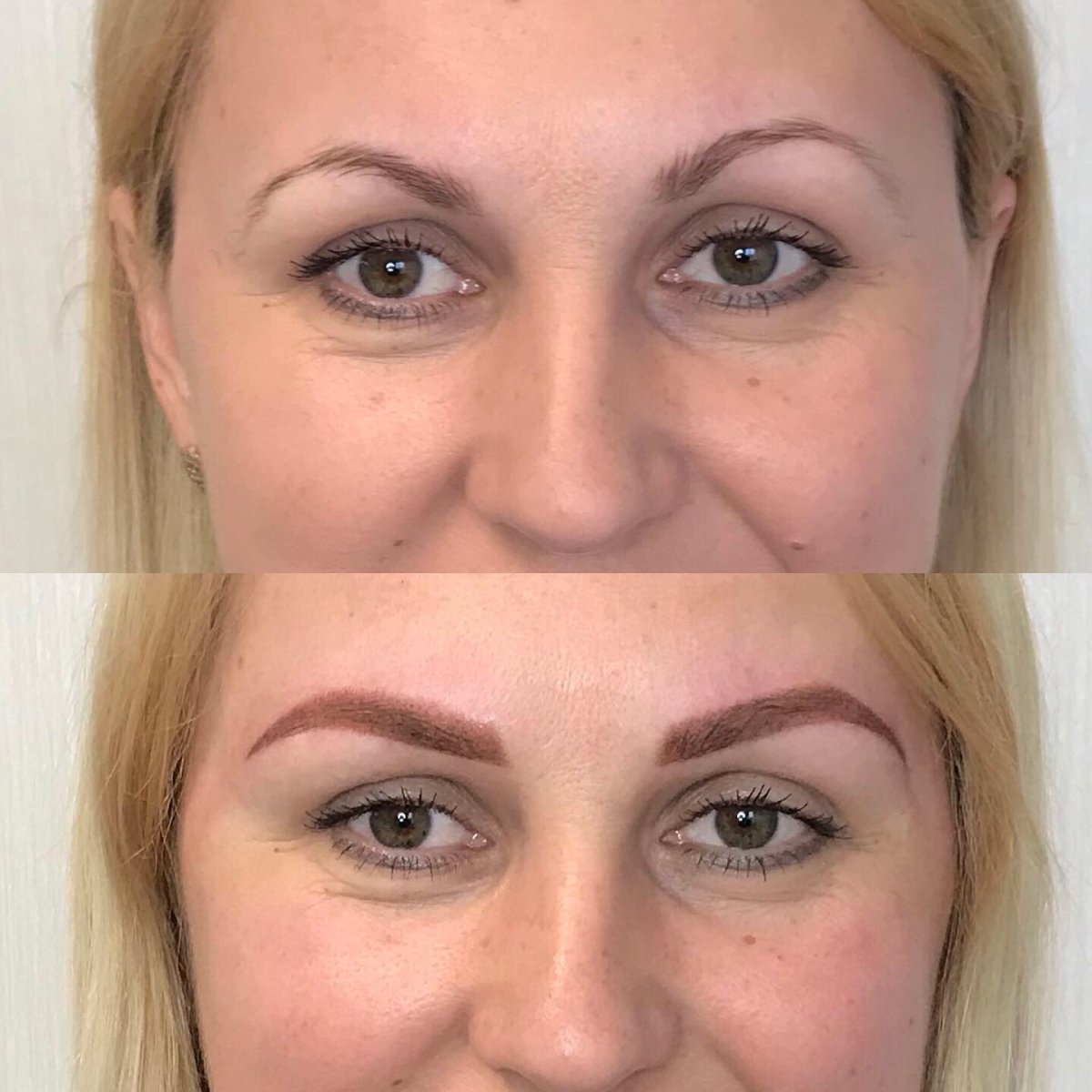 Асимметрия бровей