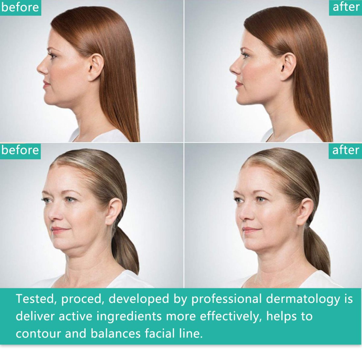 Линия подбородка