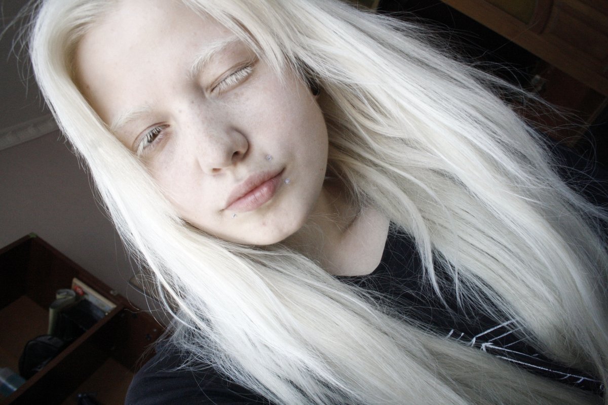 Певица альбинос