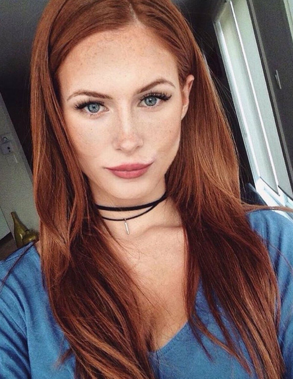 Селина Скиндер веснушки