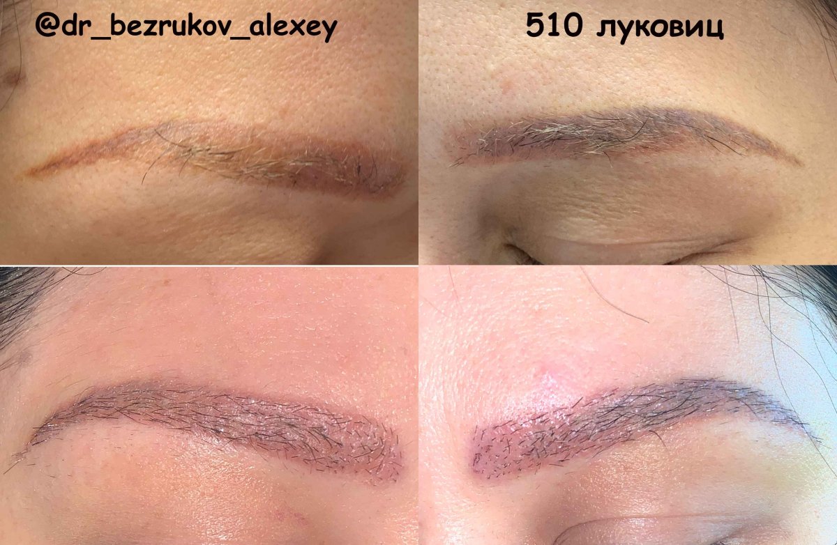 Стриженные брови