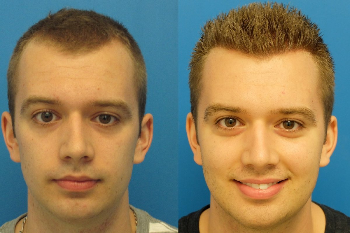 Мужской перманентный макияж