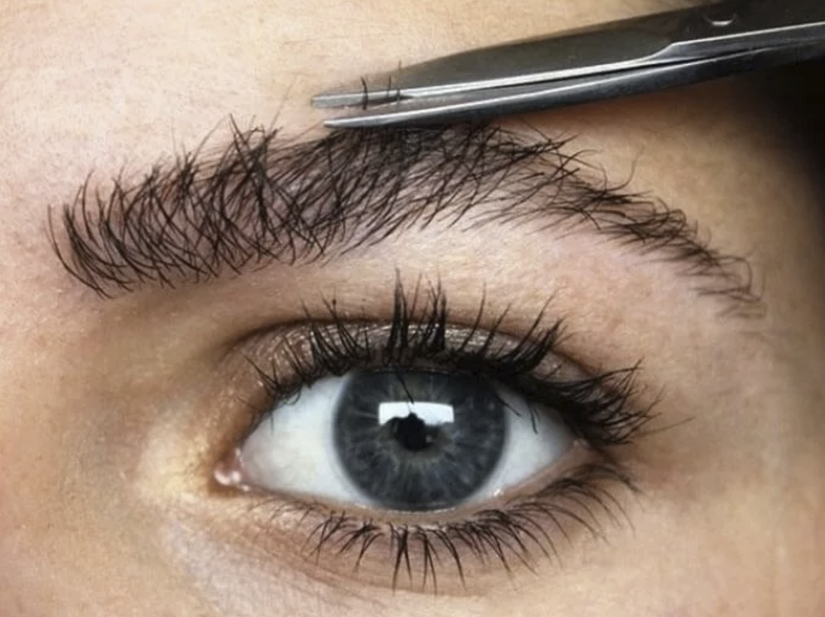 Трансплантация волос на брови