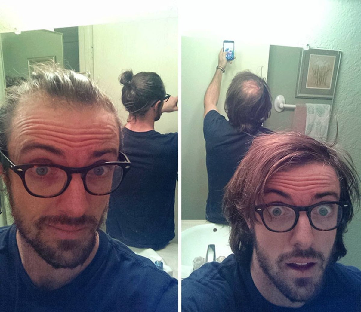 Прически скоывающие дысины