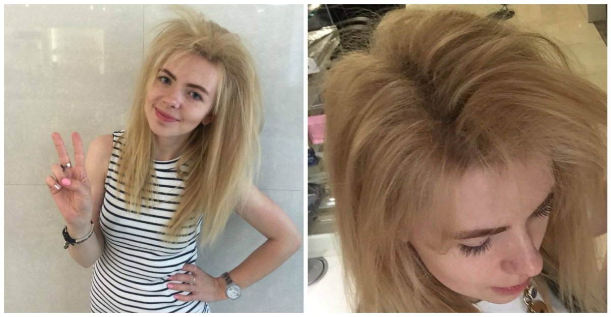 Гофре у корней